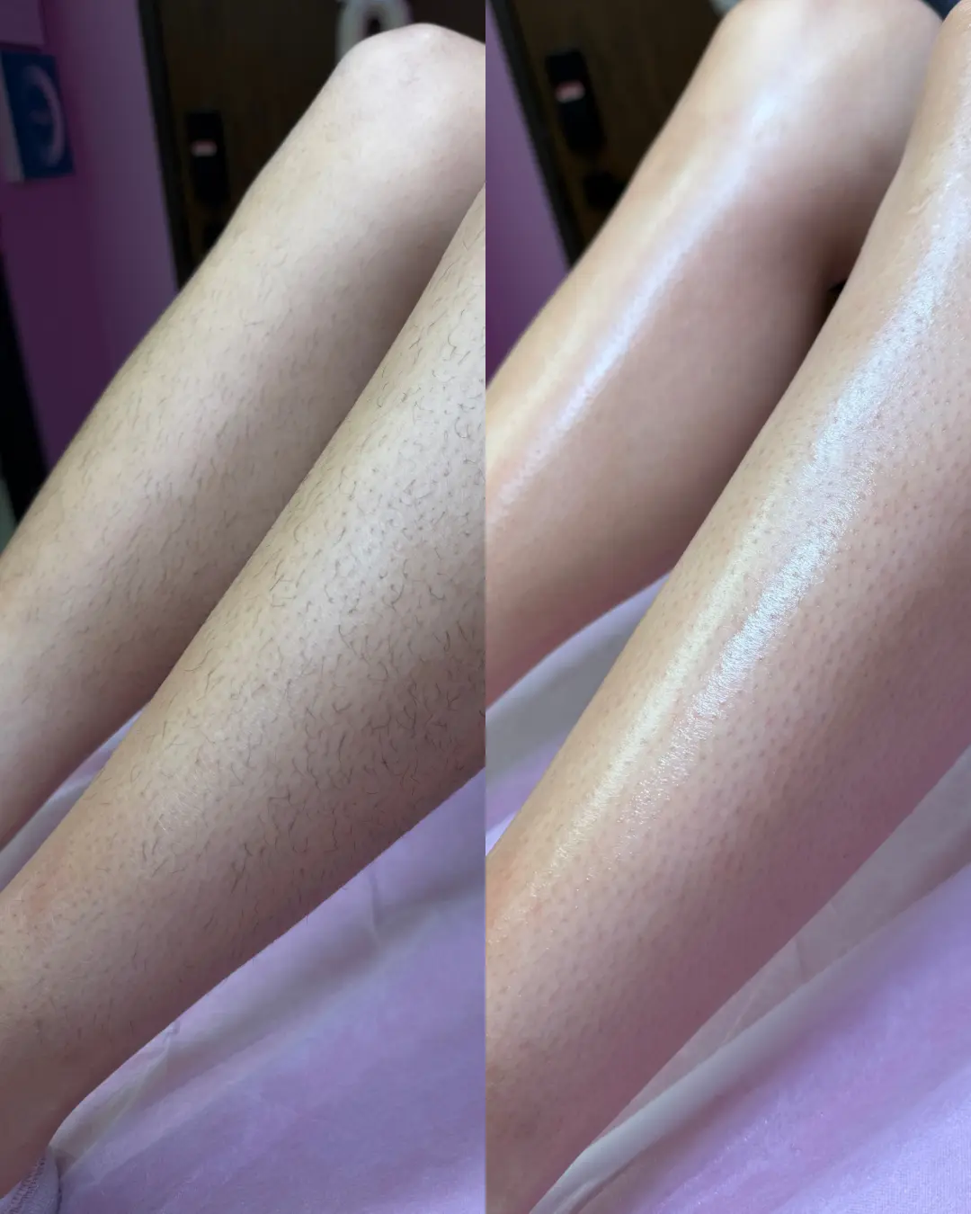 Legs before and after a full body soft wax